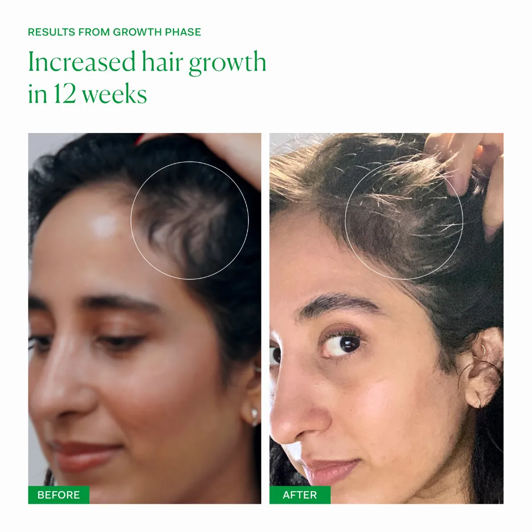 Growth Phase - Image 4