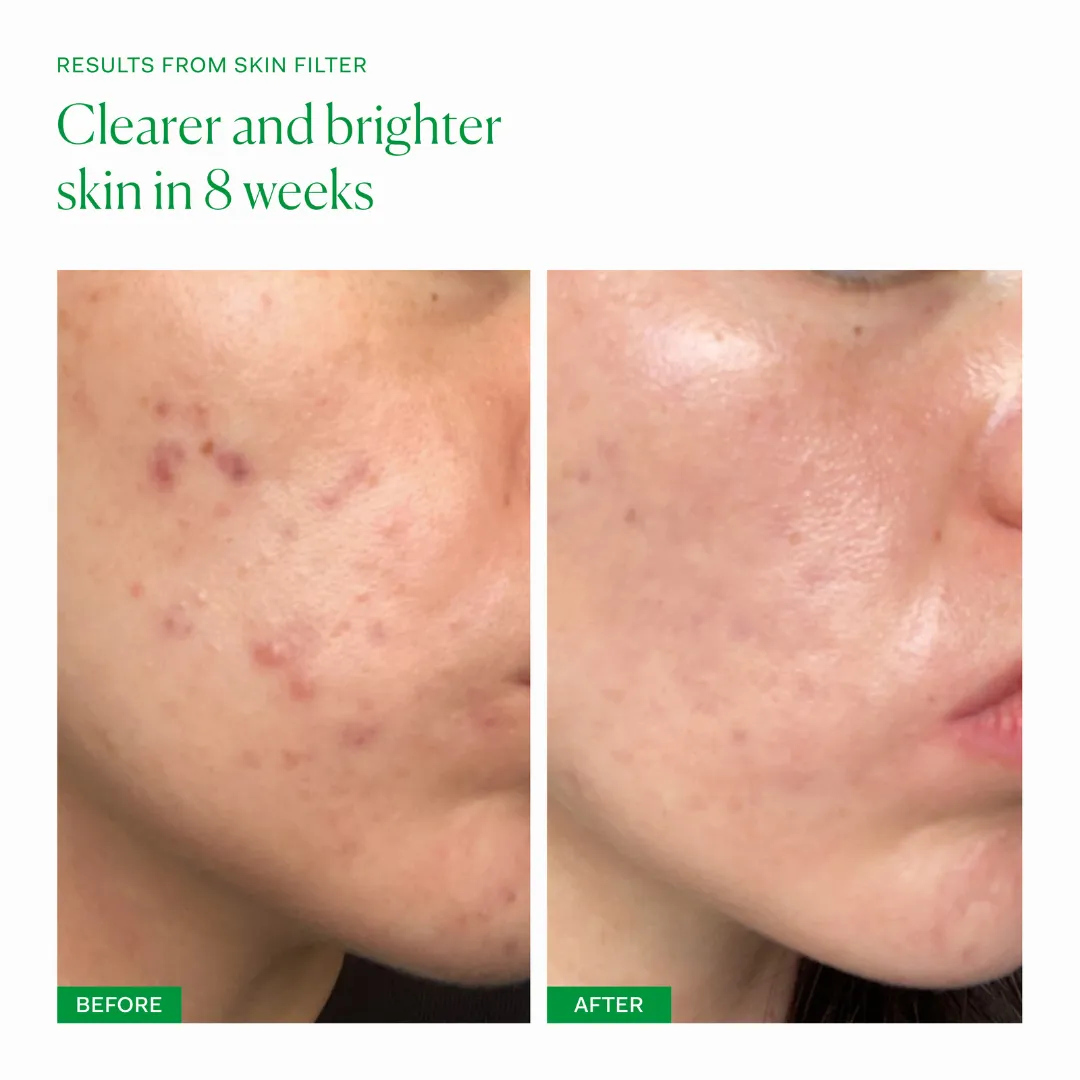 Skin Filter - Image 3